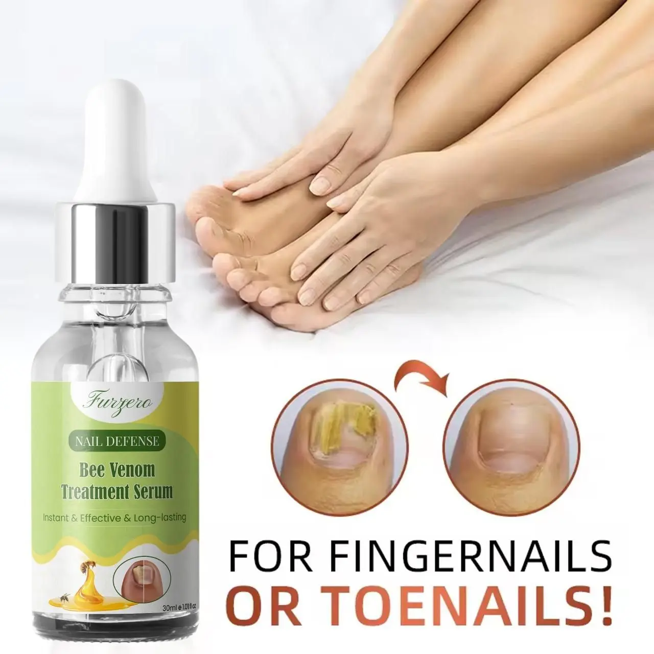 Furzero Nail Defense Bee Venom Treatment Serum 30ml(pack Of 2) - Image 3