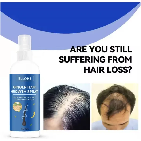 Ellohe Ginger Hair Growth Spray 120 ML Pack of 2 - Image 3
