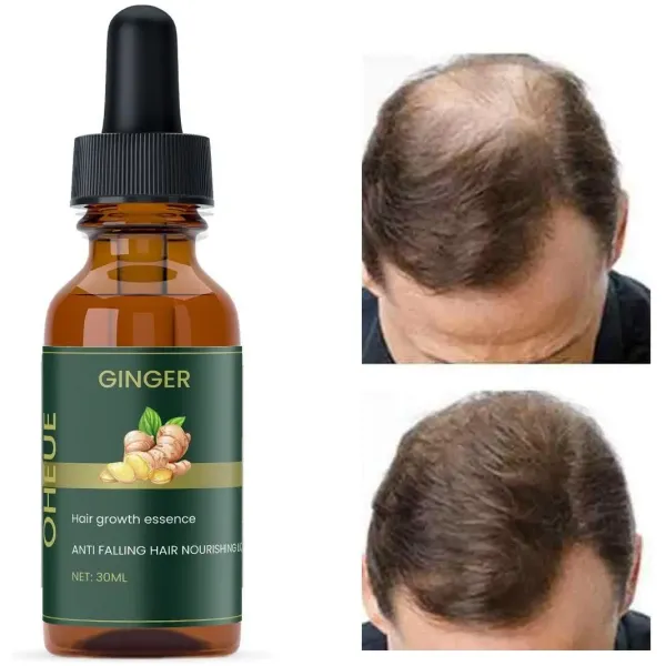 Ginger Hair Growth Essence 60ml Pack Of 2