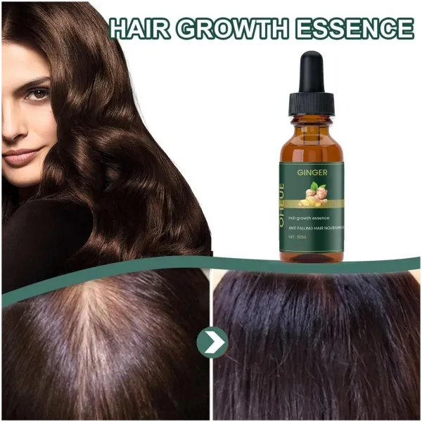 Ginger Hair Growth Essence 60ml Pack Of 2 - Image 2