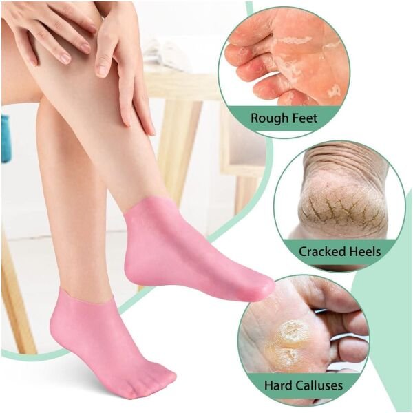 Silicone Moisturizing Socks Anti Slip Aloe Socks For Dry Cracked Feet Women (Pack Of 2 Pair) - Image 3