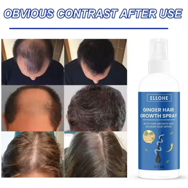 Ellohe Ginger Hair Growth Spray 120 ML Pack of 2 - Image 4