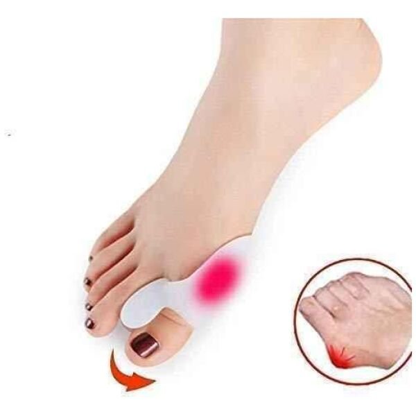 Toe Separator - Image 3